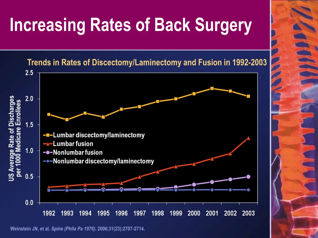 increasing rates of back surgery