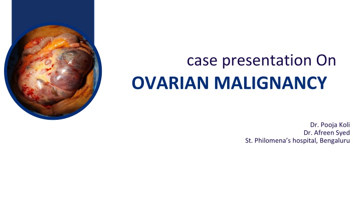 case presentation on ovarian malignancy