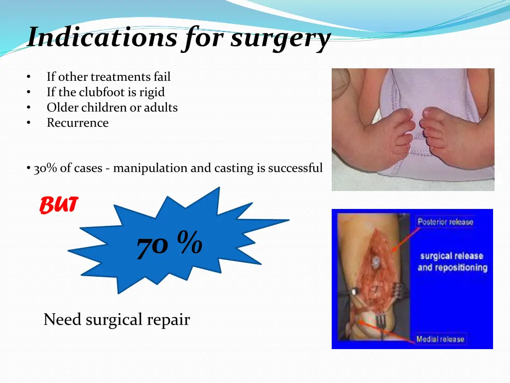 indications for surgery