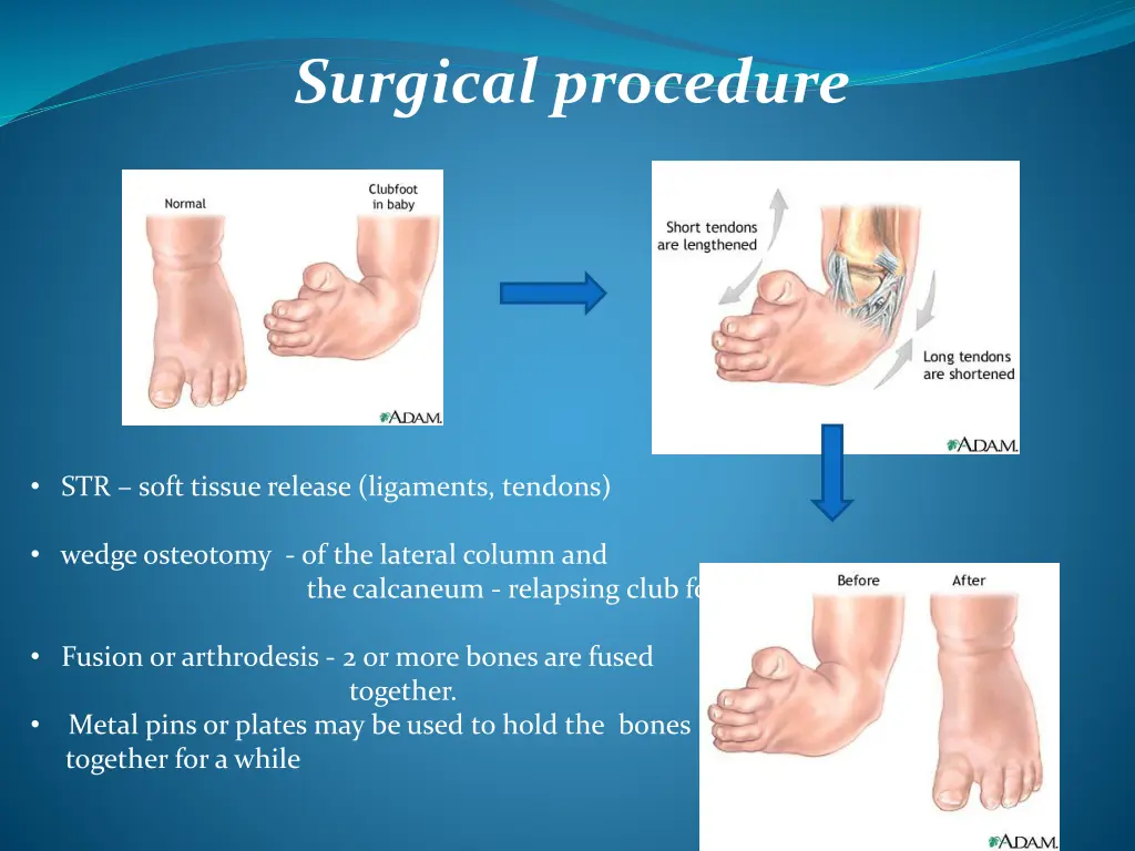 surgical procedure