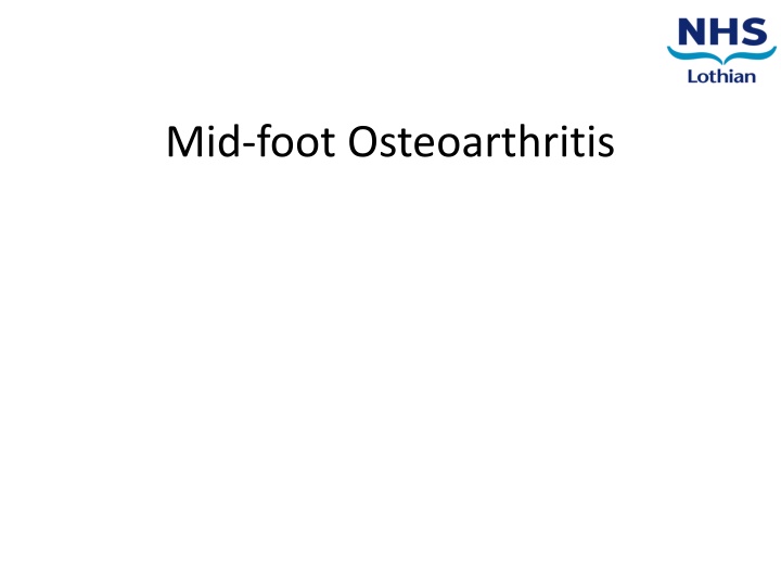 mid foot osteoarthritis