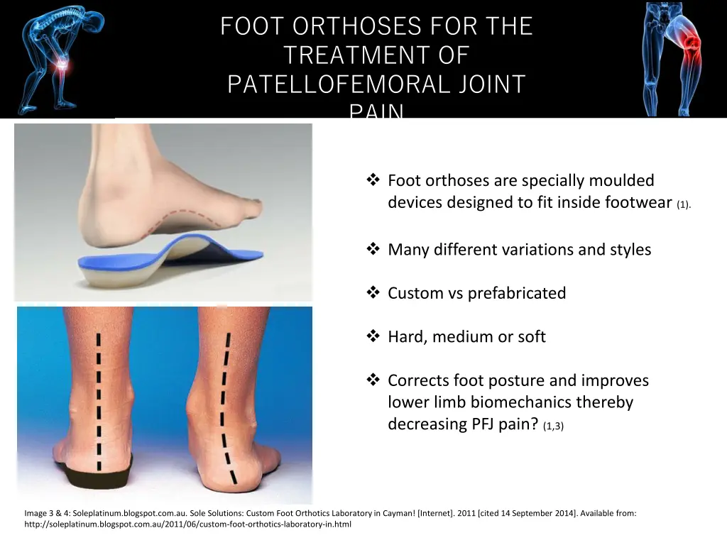 foot orthoses for the treatment of patellofemoral 4