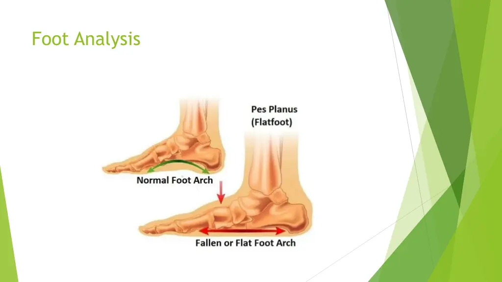 foot analysis