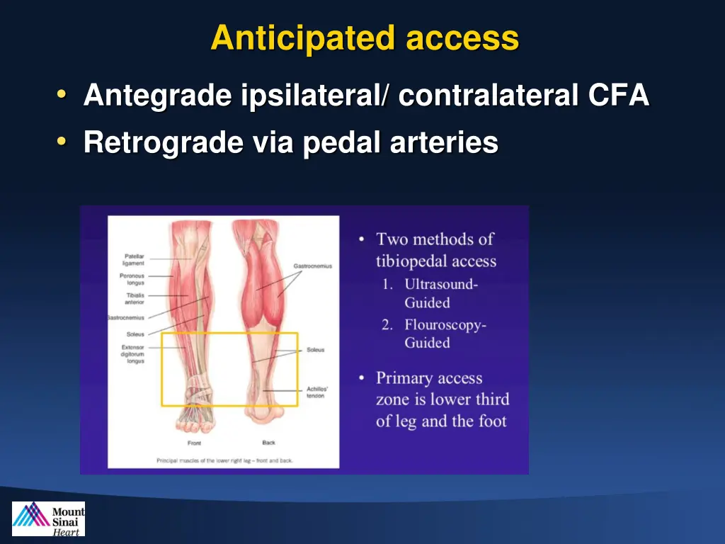 anticipated access