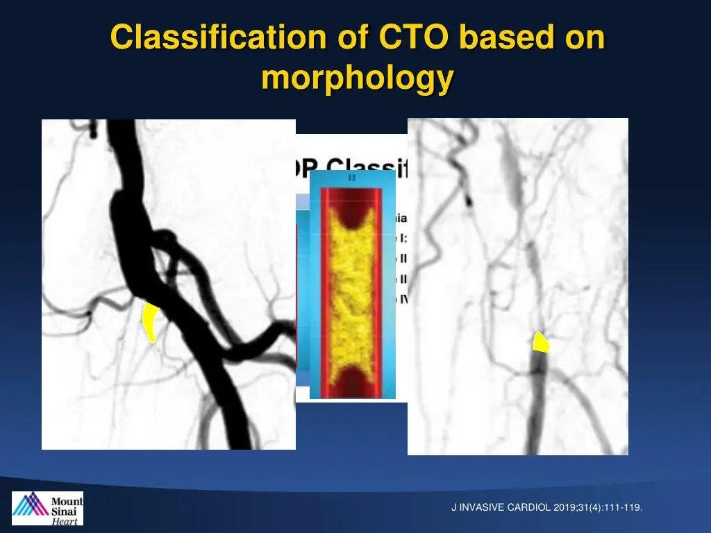 classification of cto based on morphology