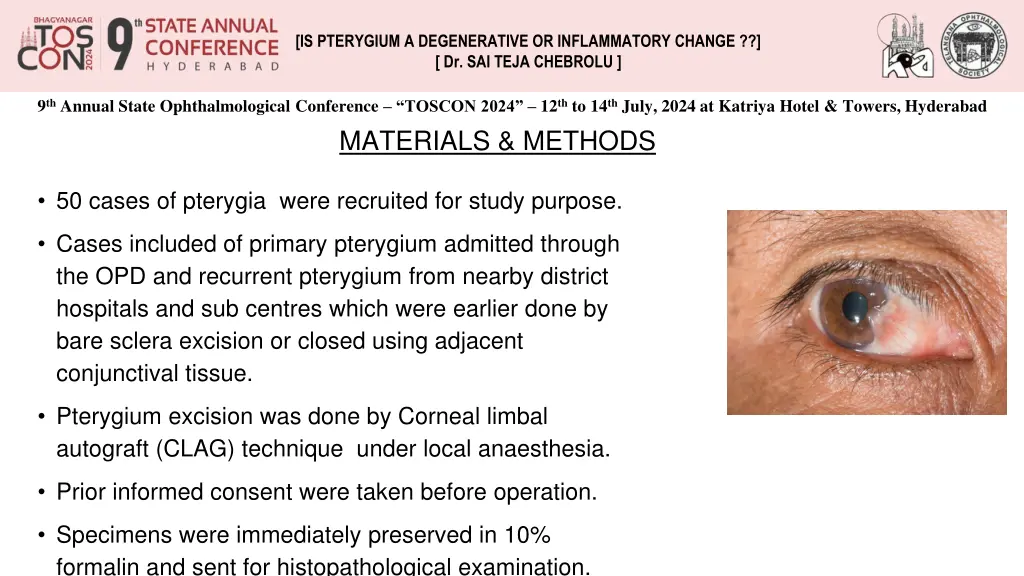 is pterygium a degenerative or inflammatory 1