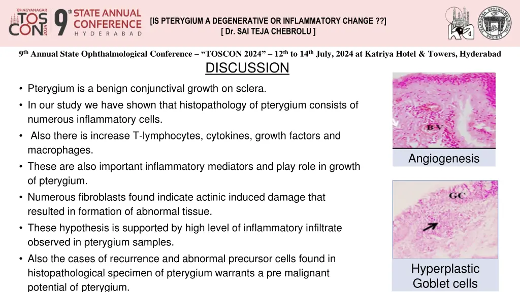 is pterygium a degenerative or inflammatory 2