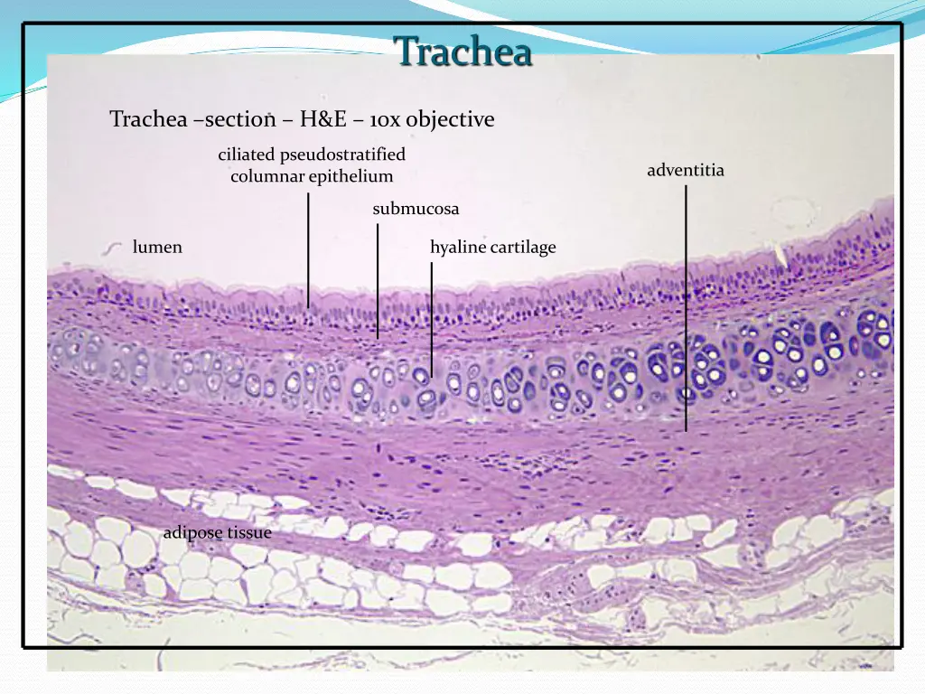 trachea