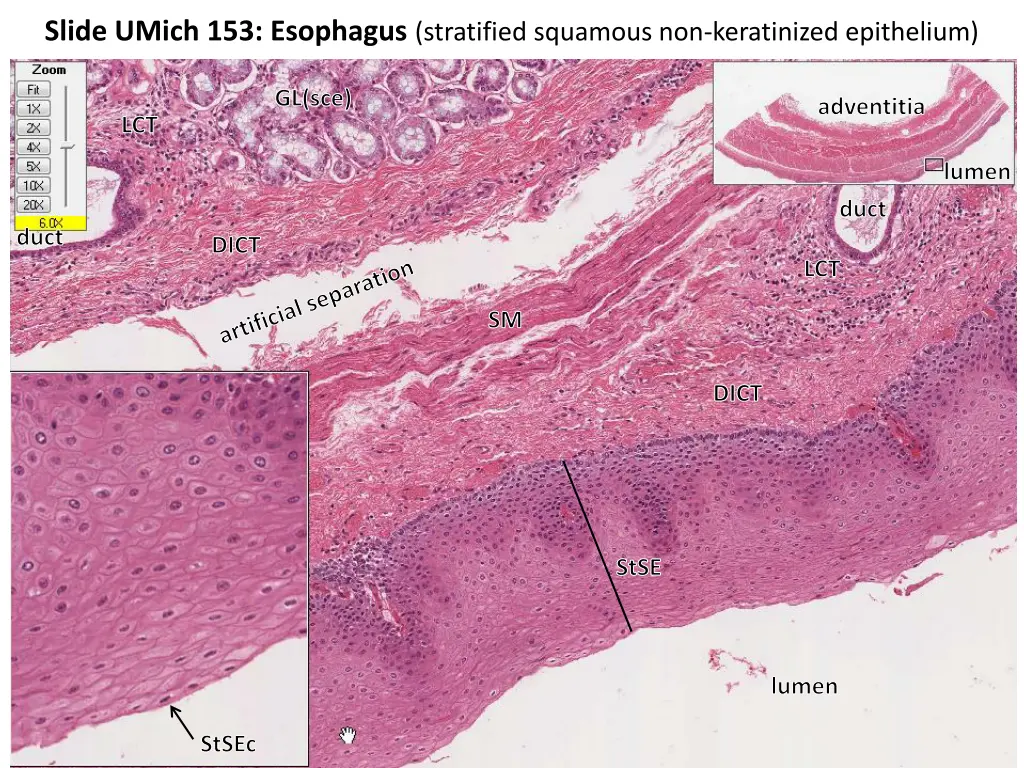 slide umich 153 esophagus stratified squamous