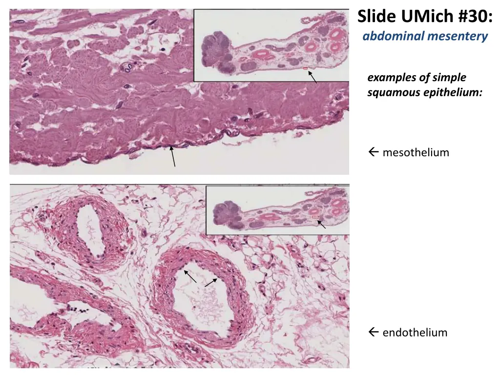 slide umich 30 abdominal mesentery