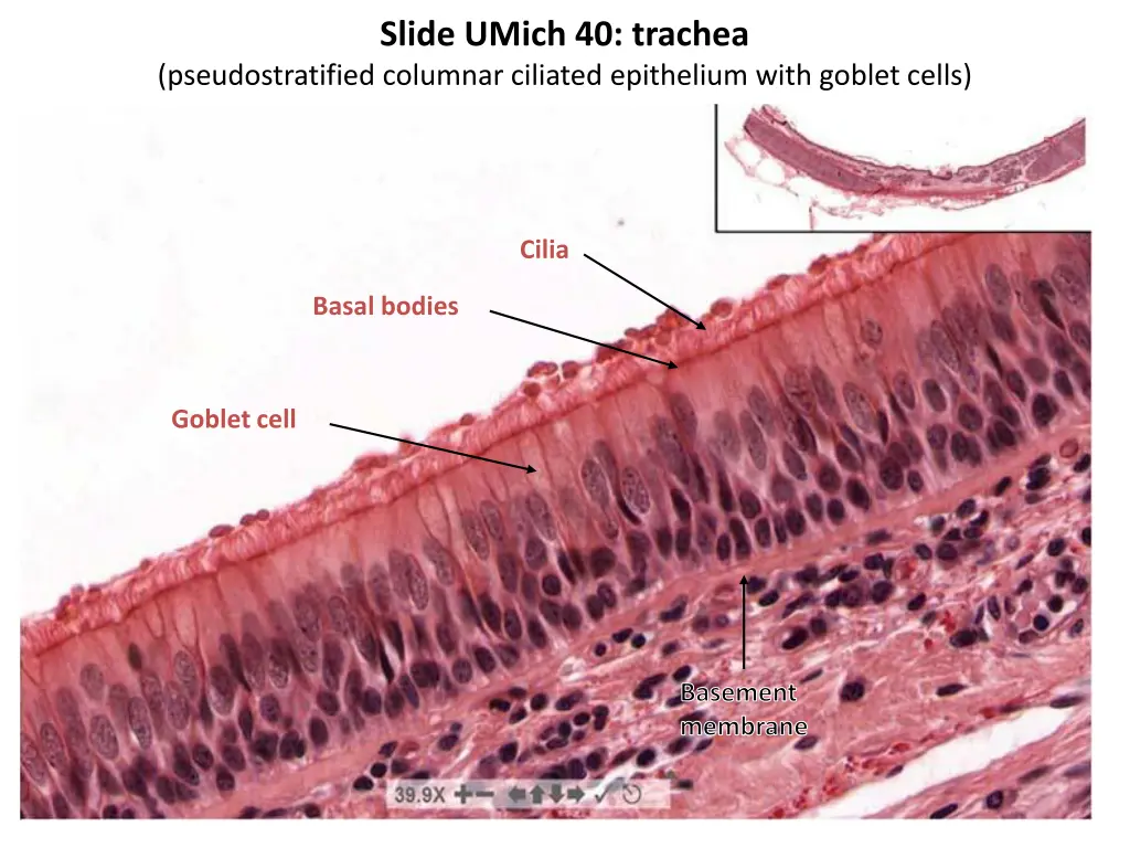 slide umich 40 trachea