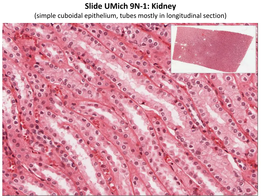 slide umich 9n 1 kidney 1