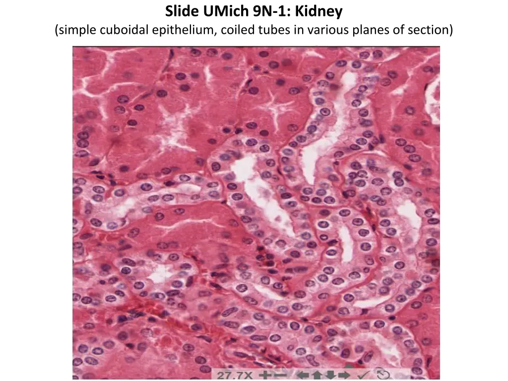 slide umich 9n 1 kidney