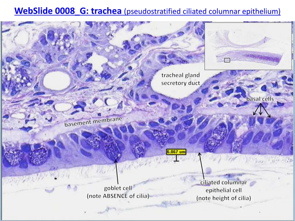 webslide 0008 g trachea pseudostratified ciliated