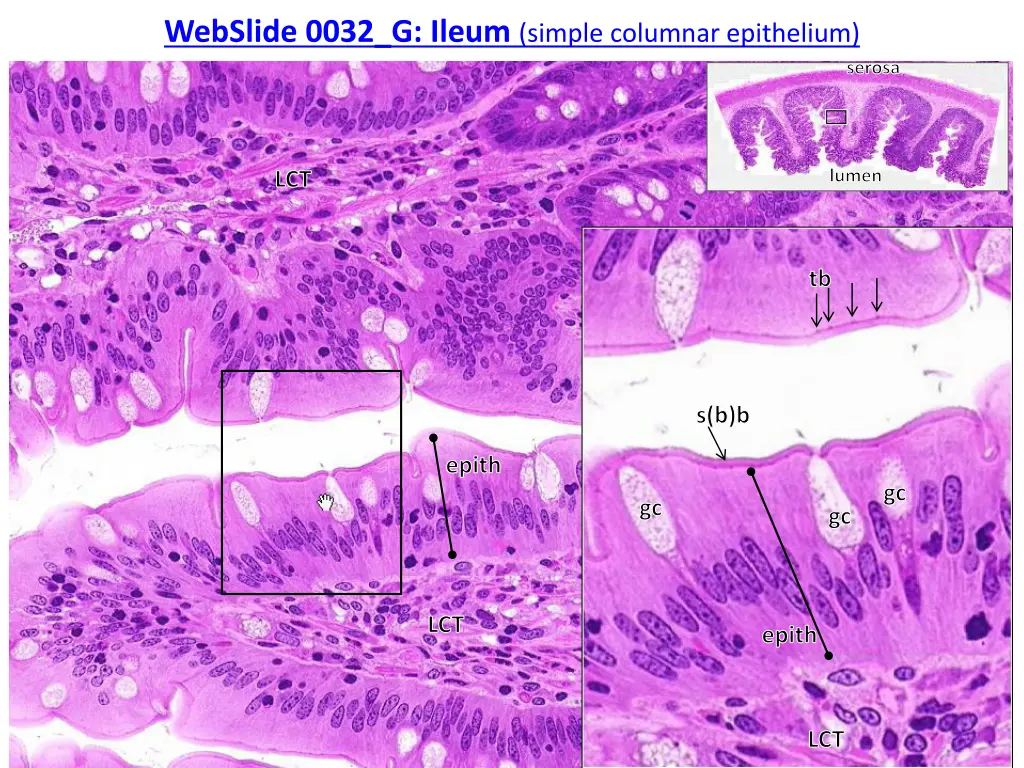 webslide 0032 g ileum simple columnar epithelium