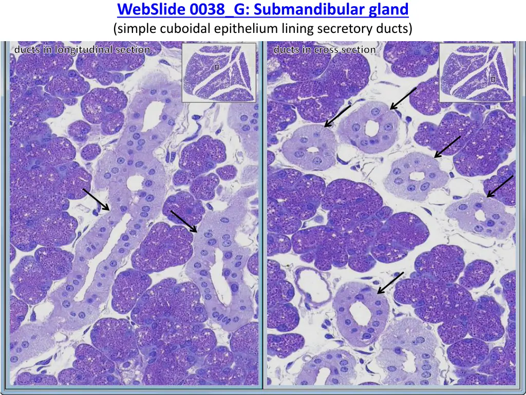 webslide 0038 g submandibular gland simple