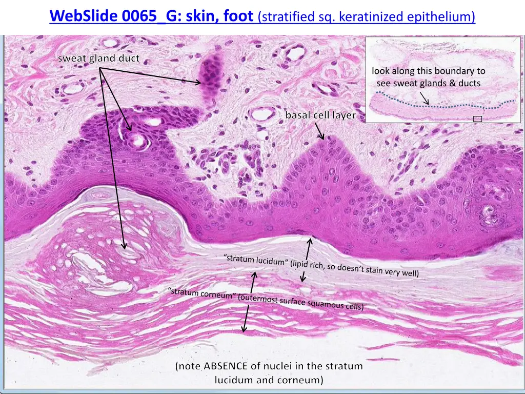 webslide 0065 g skin foot stratified