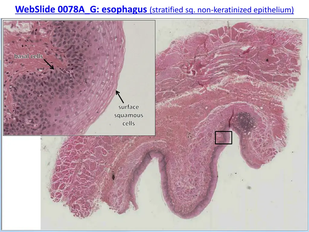 webslide 0078a g esophagus stratified