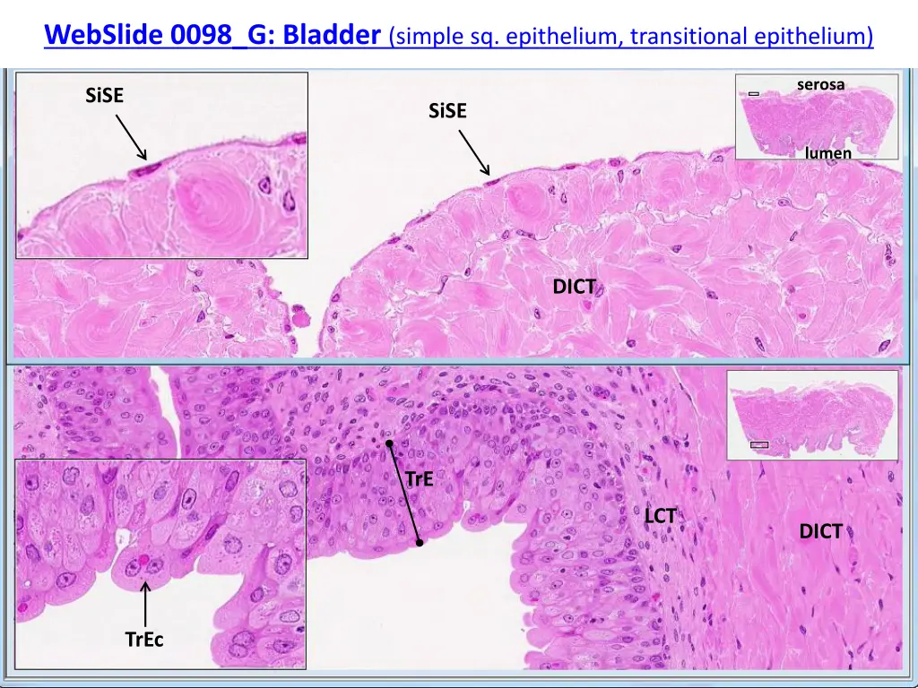 webslide 0098 g bladder simple sq epithelium