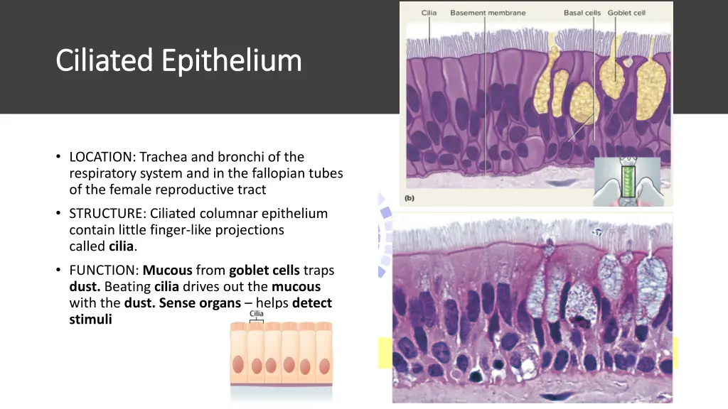 ciliated epithelium ciliated epithelium