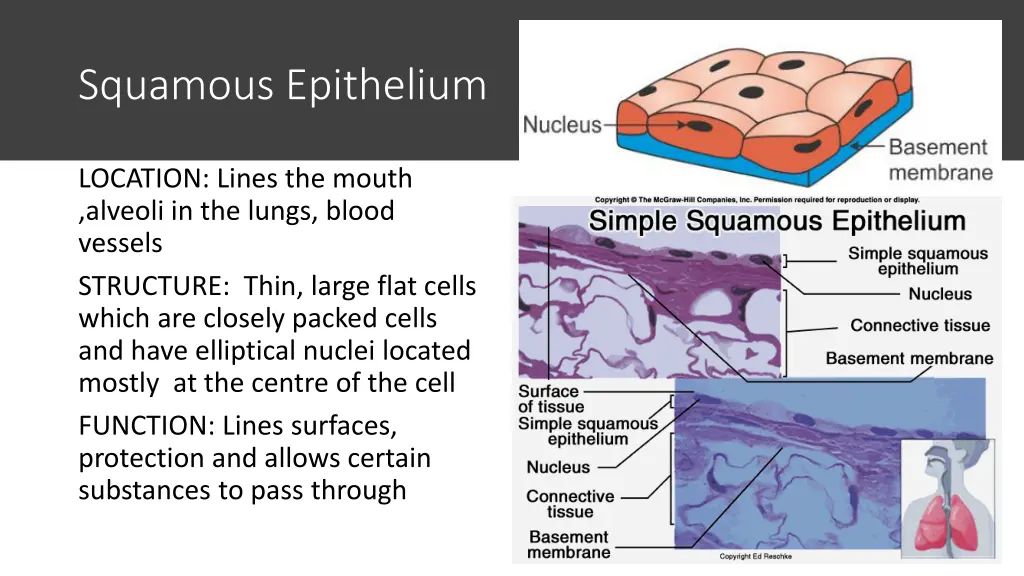 squamous epithelium