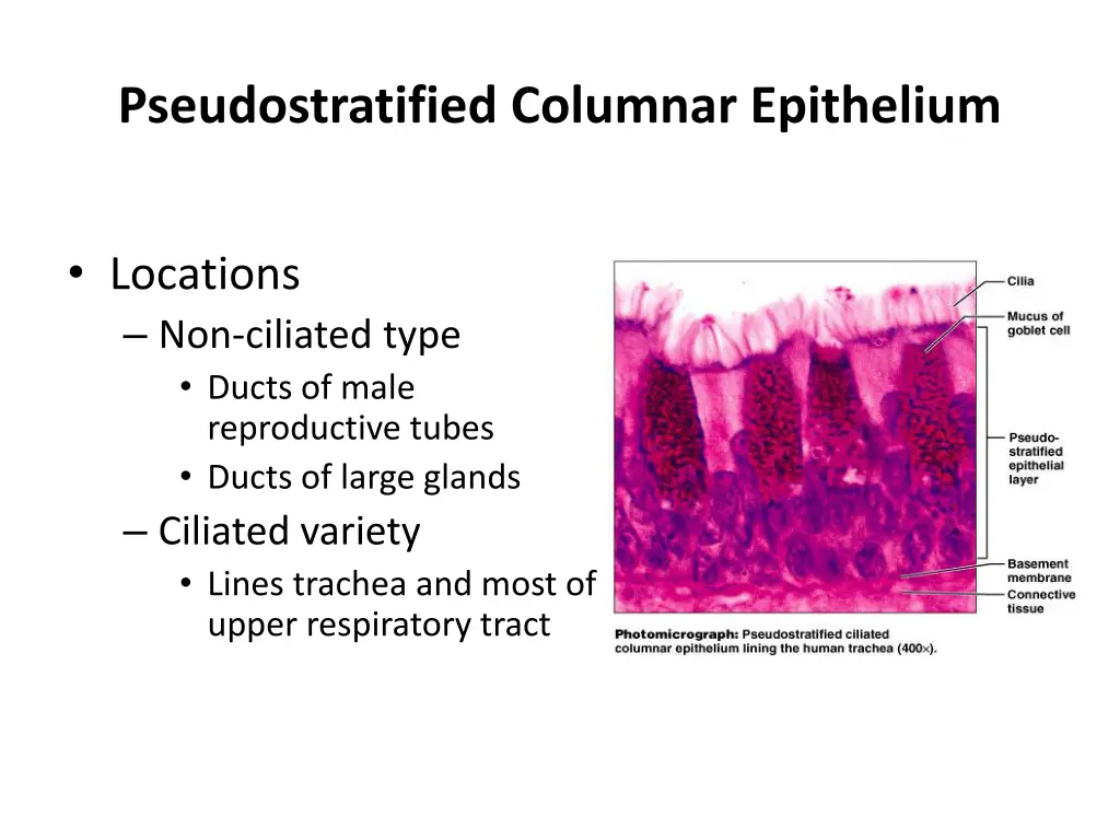 pseudostratified columnar epithelium 1