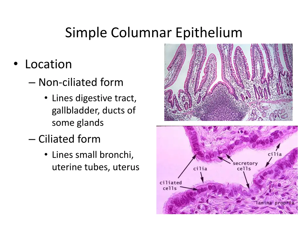 simple columnar epithelium 1