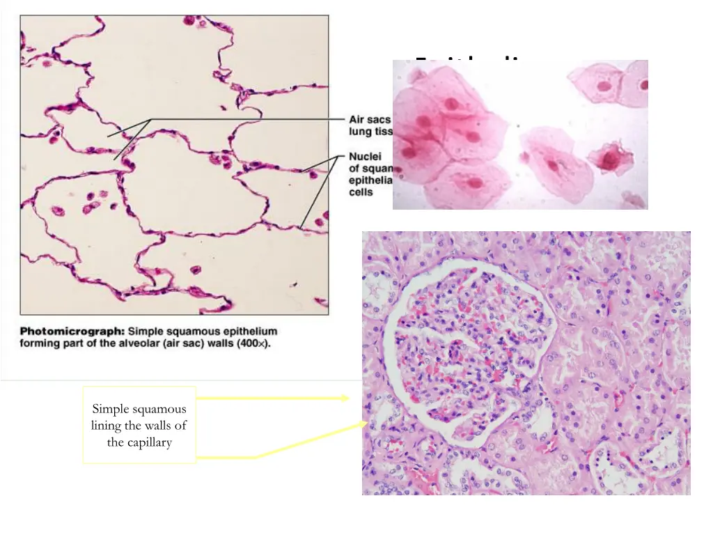 simple squamous epithelium 2