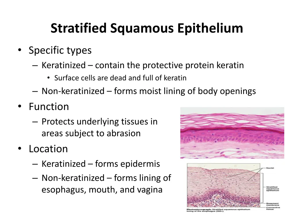 stratified squamous epithelium 1