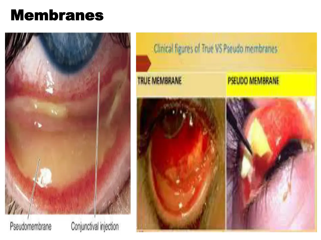 membranes membranes