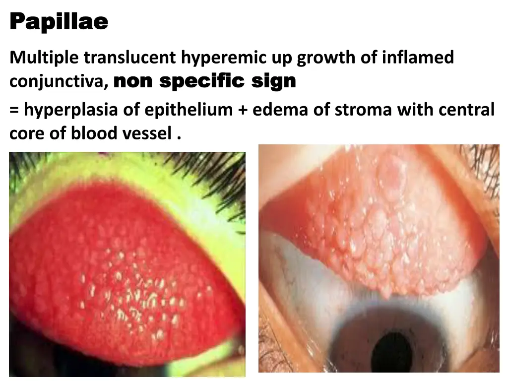 papillae papillae