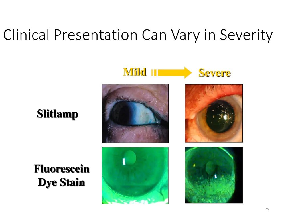 clinical presentation can vary in severity