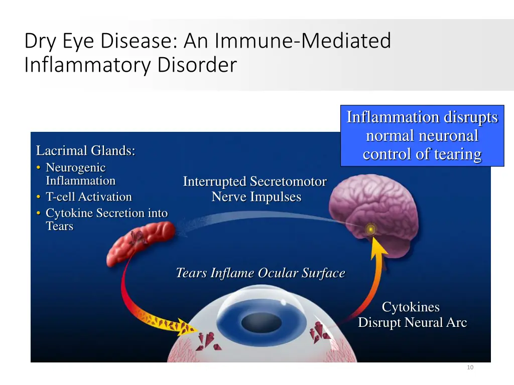 dry eye disease an immune mediated inflammatory