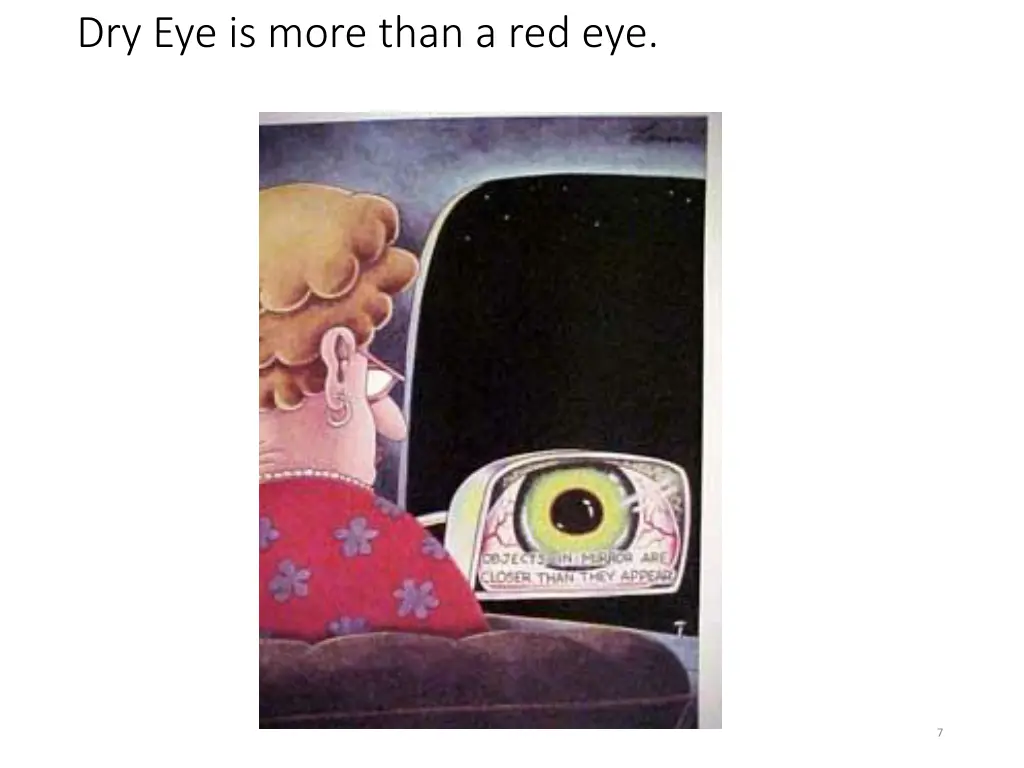 dry eye is more than a red eye