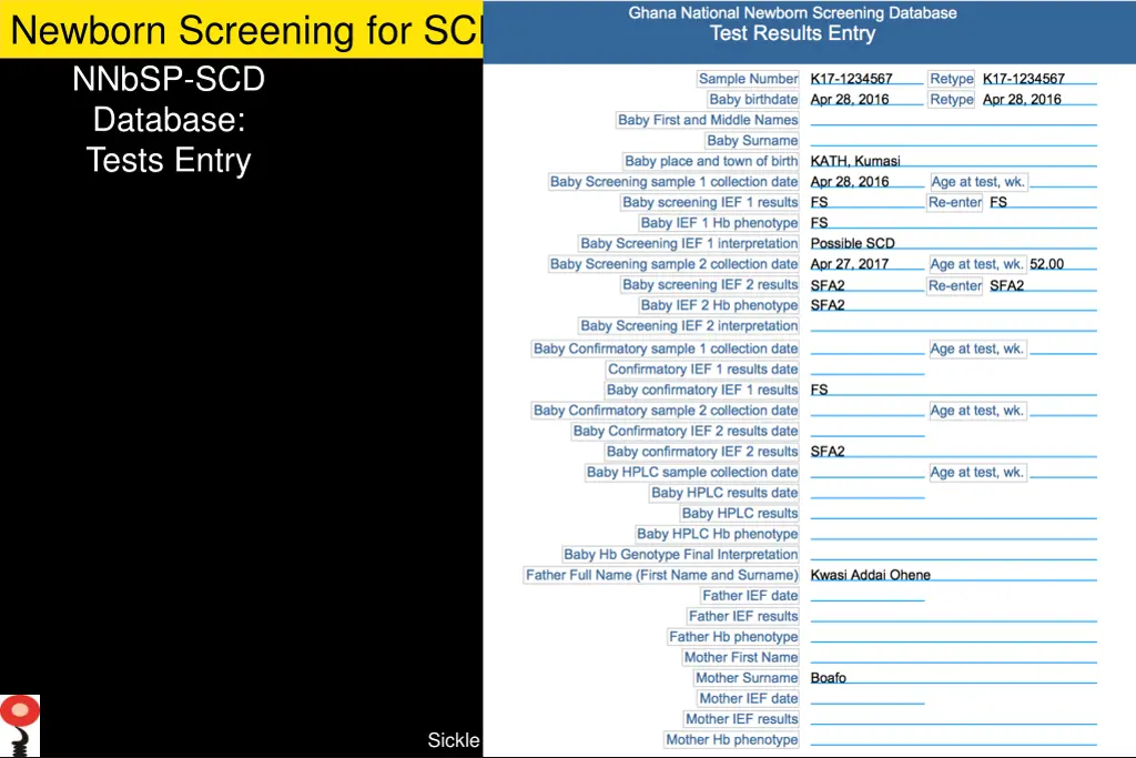 newborn screening for scd in ghana nnbsp 2