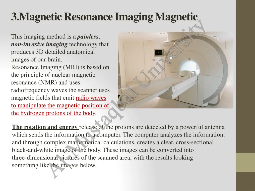 3 magneticresonanceimagingmagnetic