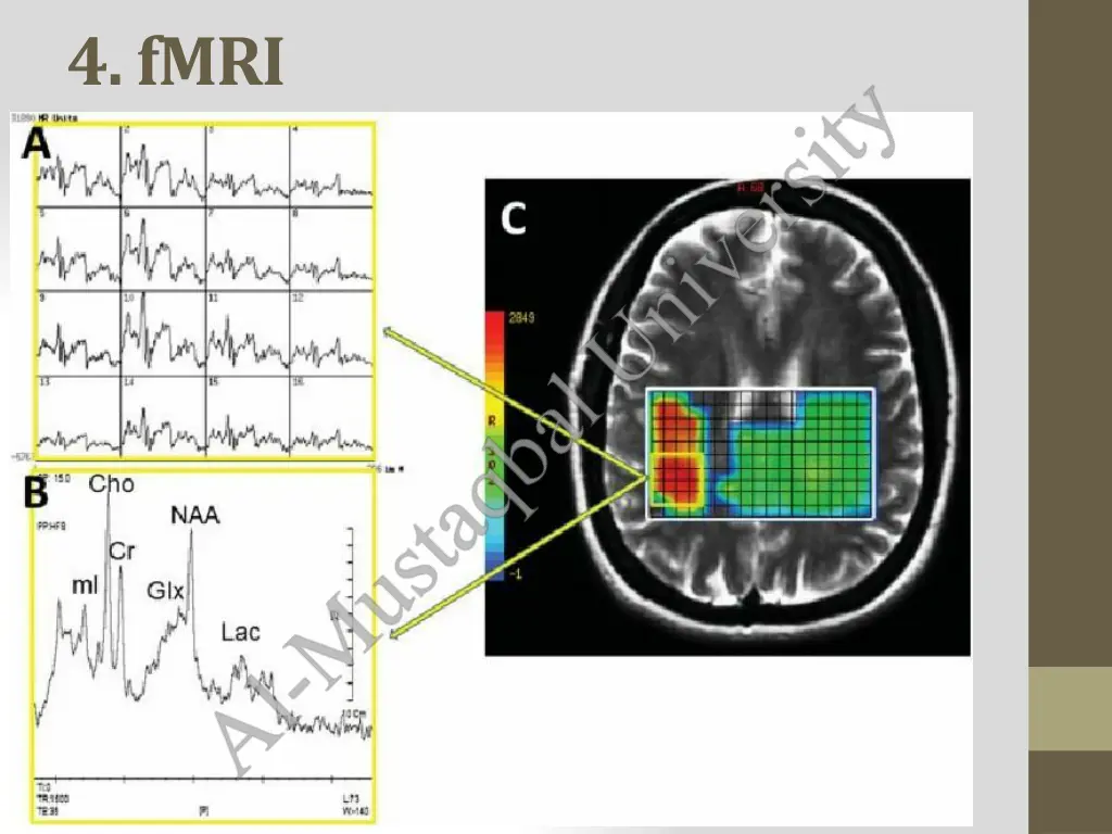 4 fmri 1