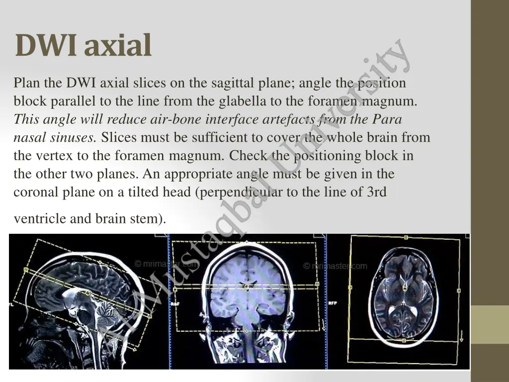 dwiaxial