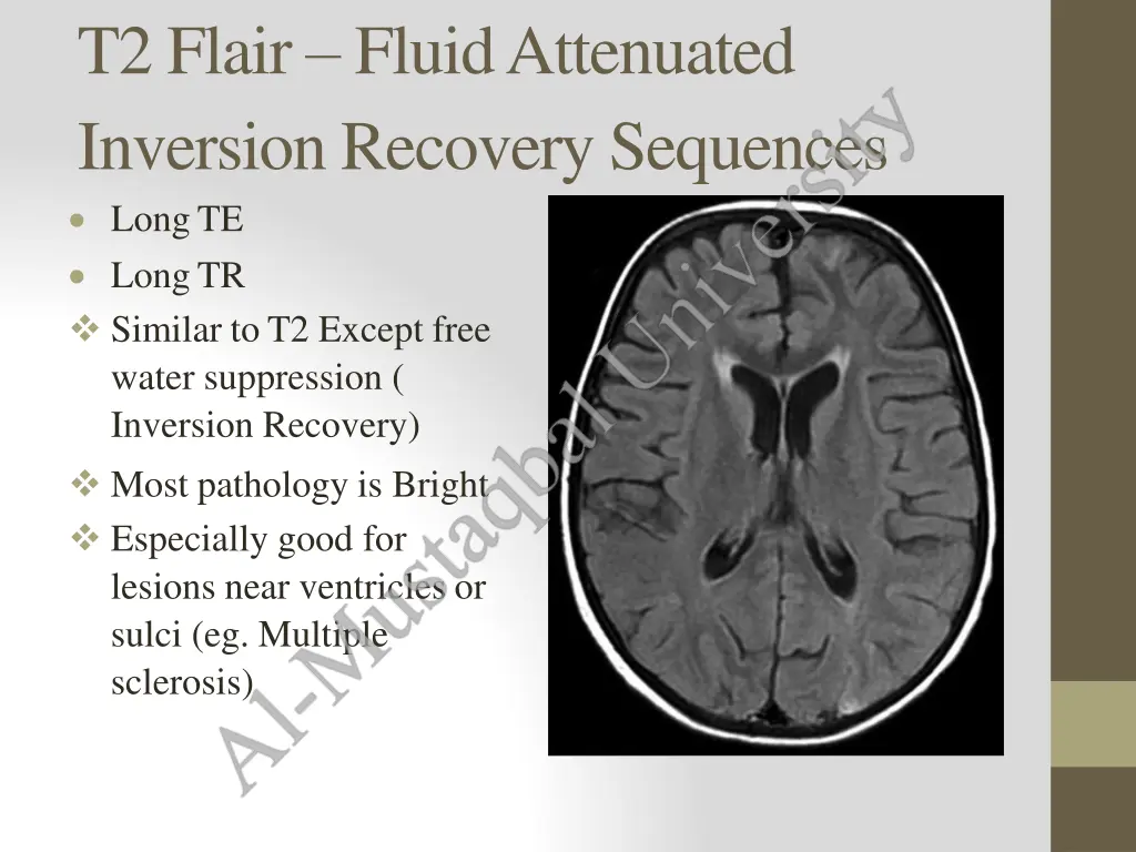 t2 flair fluidattenuated