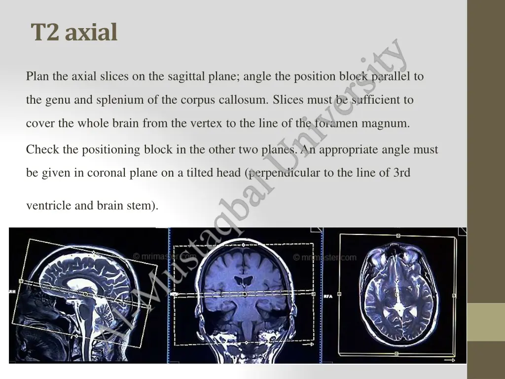 t2axial