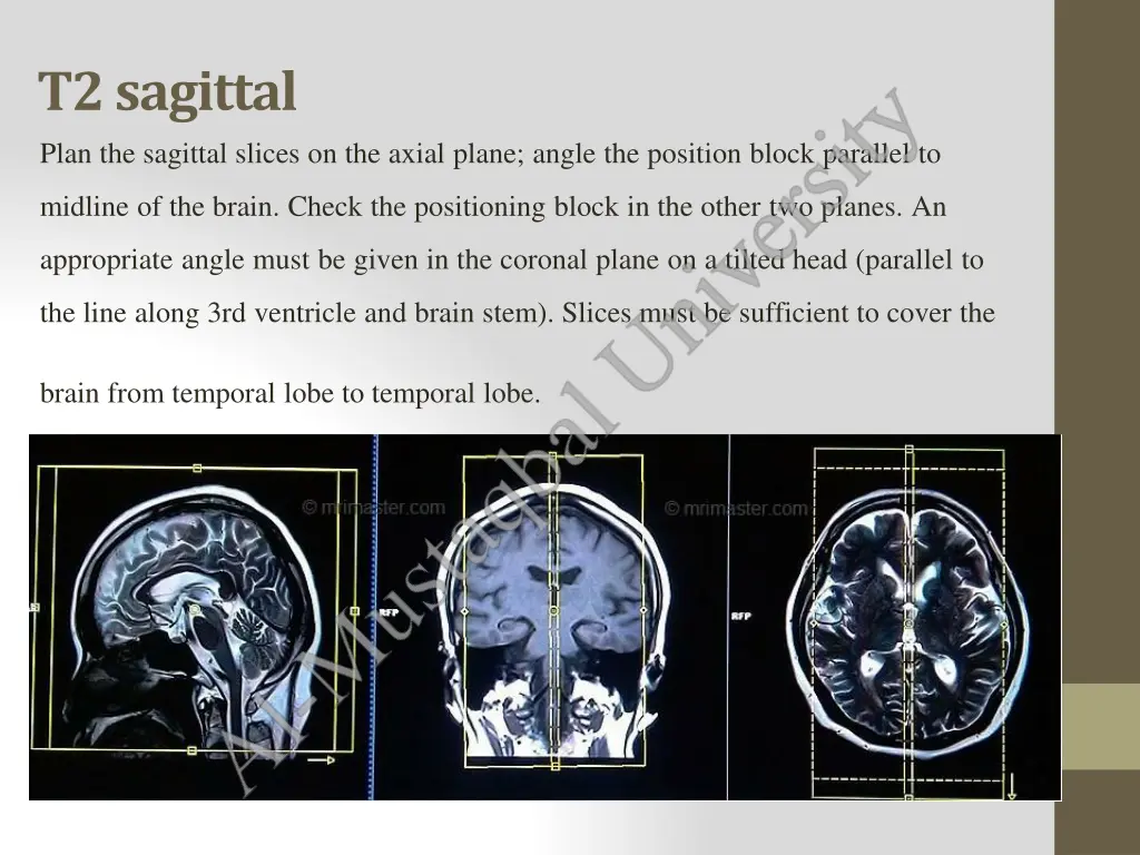 t2sagittal plan the sagittal slices on the axial