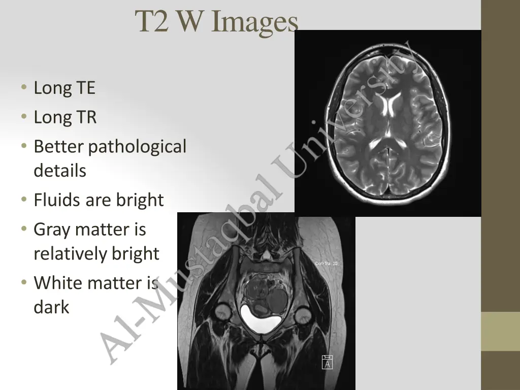 t2wimages