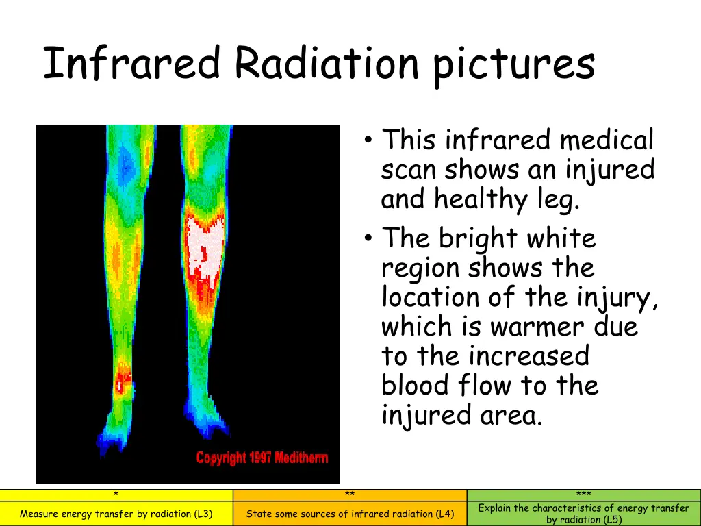 infrared radiation pictures 5