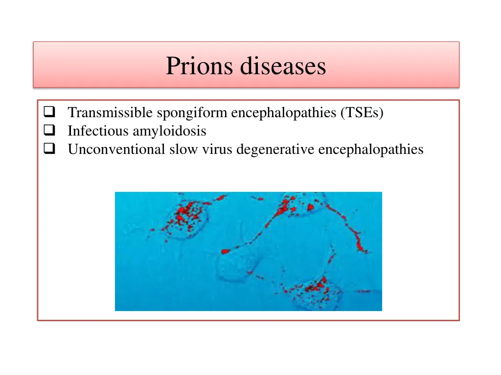 prions diseases