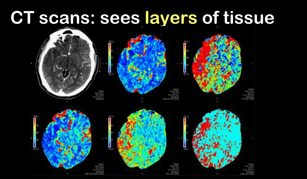 ct scans sees layers of tissue