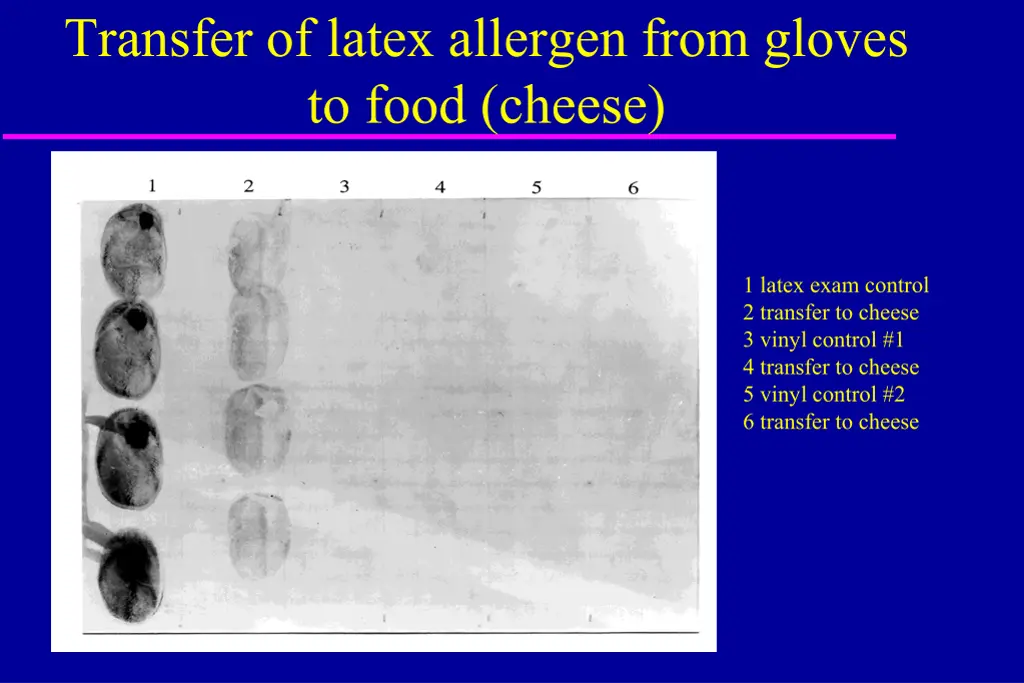 transfer of latex allergen from gloves to food