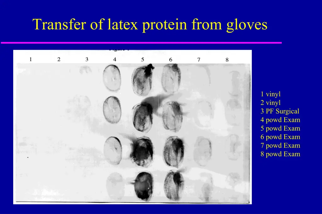 transfer of latex protein from gloves