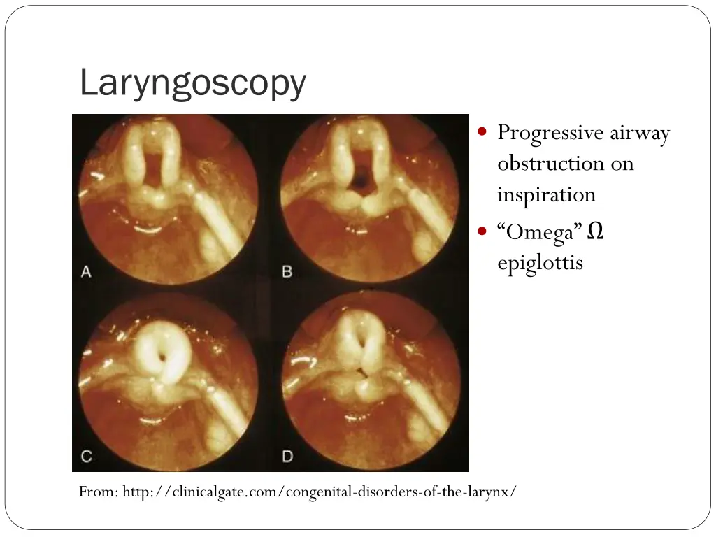 laryngoscopy