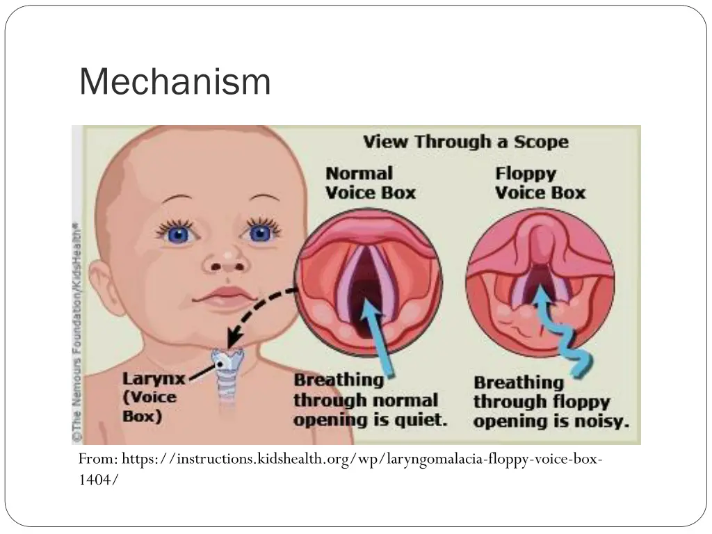 mechanism