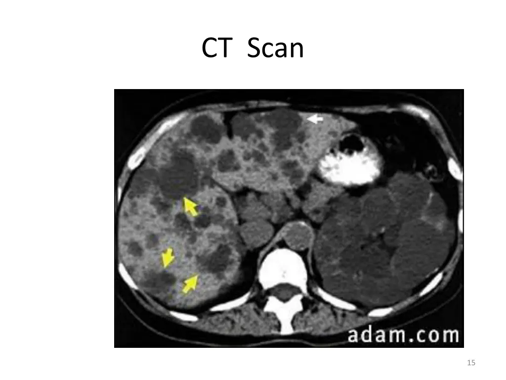 ct scan